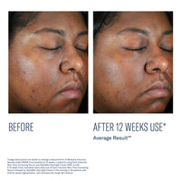 Even Intensive Skin Tone Correcting Serum