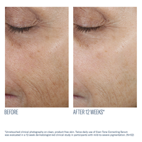 Even Skin Tone Correcting Serum