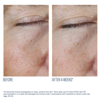 Instant Effect Gel EYE