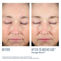 Mystro Revive Renewing Serum