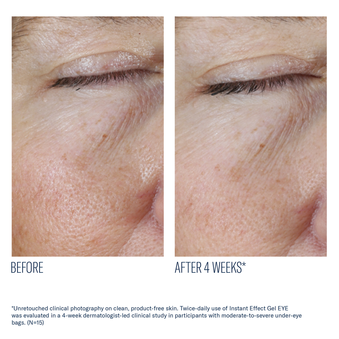 Instant Effect Gel EYE