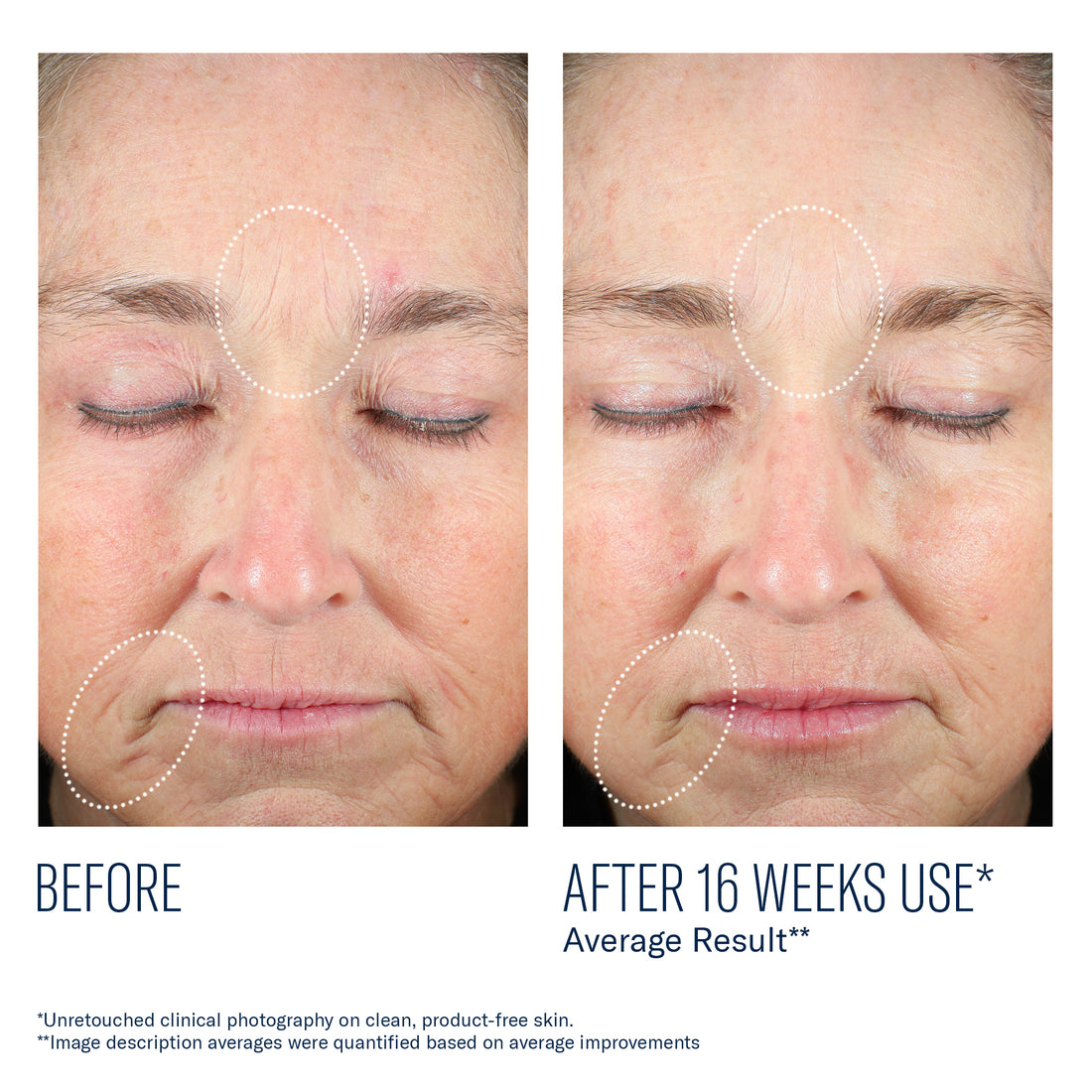 Mystro Revive Renewing Serum