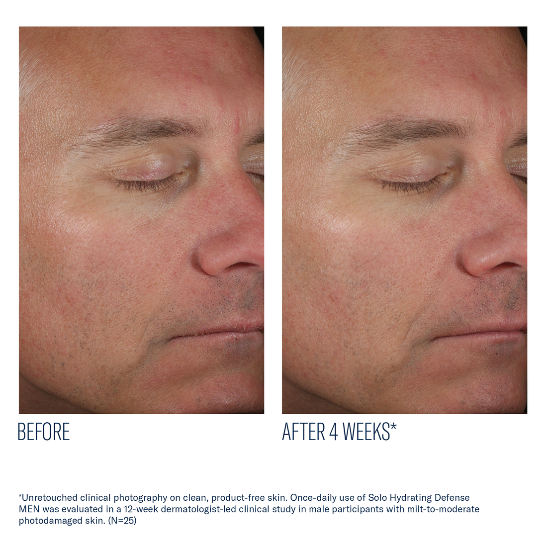 Solo Hydrating Defense Men