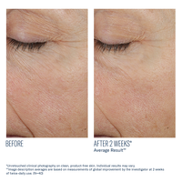 Trio Rebalancing Moisture Treatment